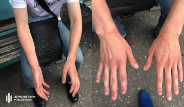 Патрульний постане перед судом через побиття неповнолітнього в Одесі
