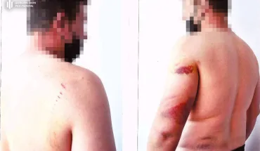 Побиття громадян у відділі поліції на Херсонщині – ДБР повідомило про підозру ексоперуповноваженому