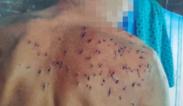 На Херсонщині повідомлено про підозру майстру лісу, який вистрелив у спину чоловіка з рушниці