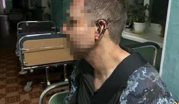 ДБР розслідує побиття військового в одній з військових частин на Одещині