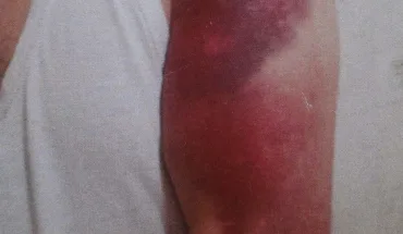 ДБР повідомило про підозру двом оперативникам поліції через побиття чоловіка під час затримання (ВІДЕО)